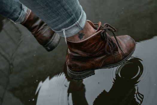 Close up of a person looking at swelling in their ankles