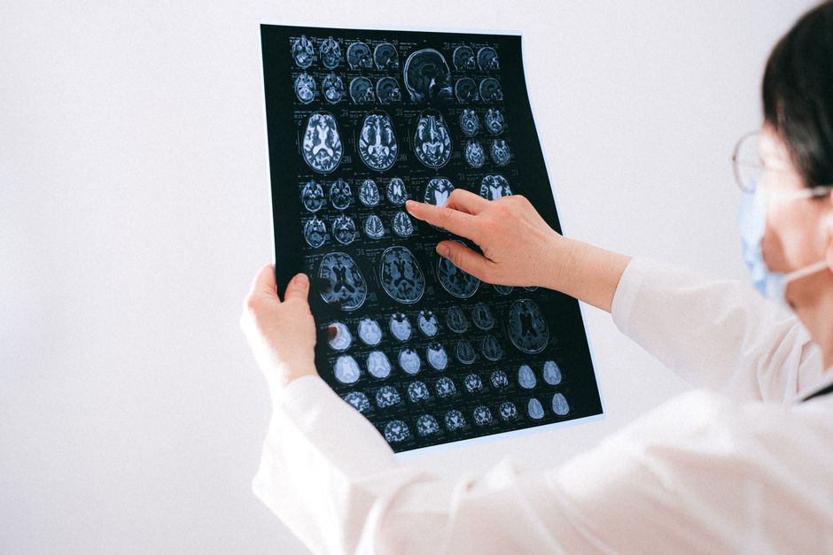 Early Signs of Neurological Disorders You Shouldnt Ignore illustration 5