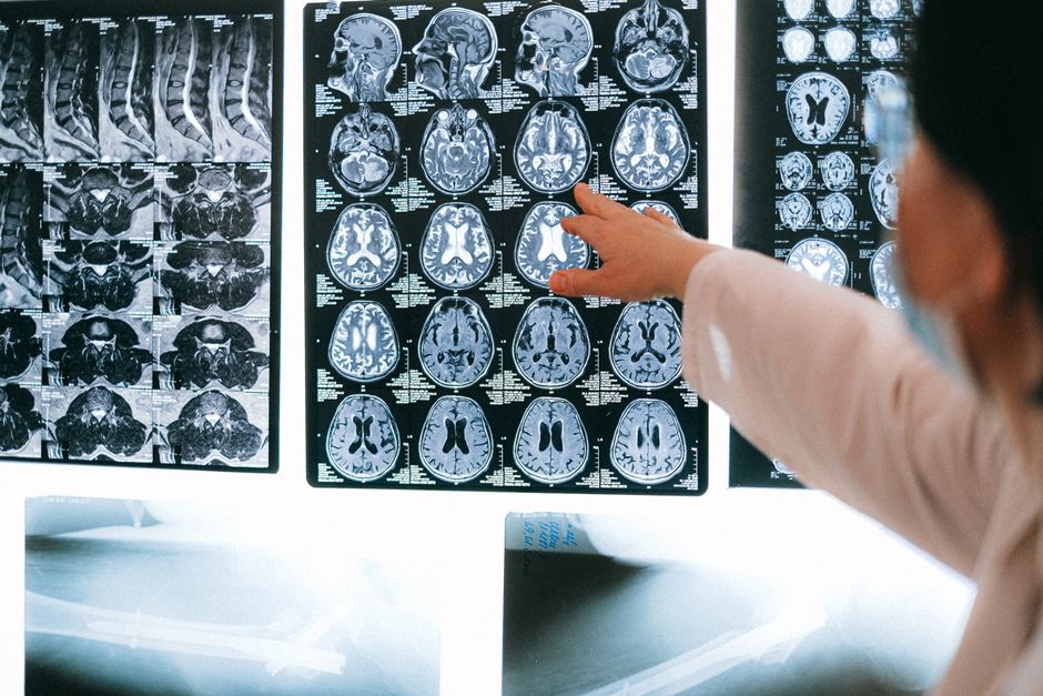 Early Signs of Neurological Disorders You Shouldnt Ignore illustration 3