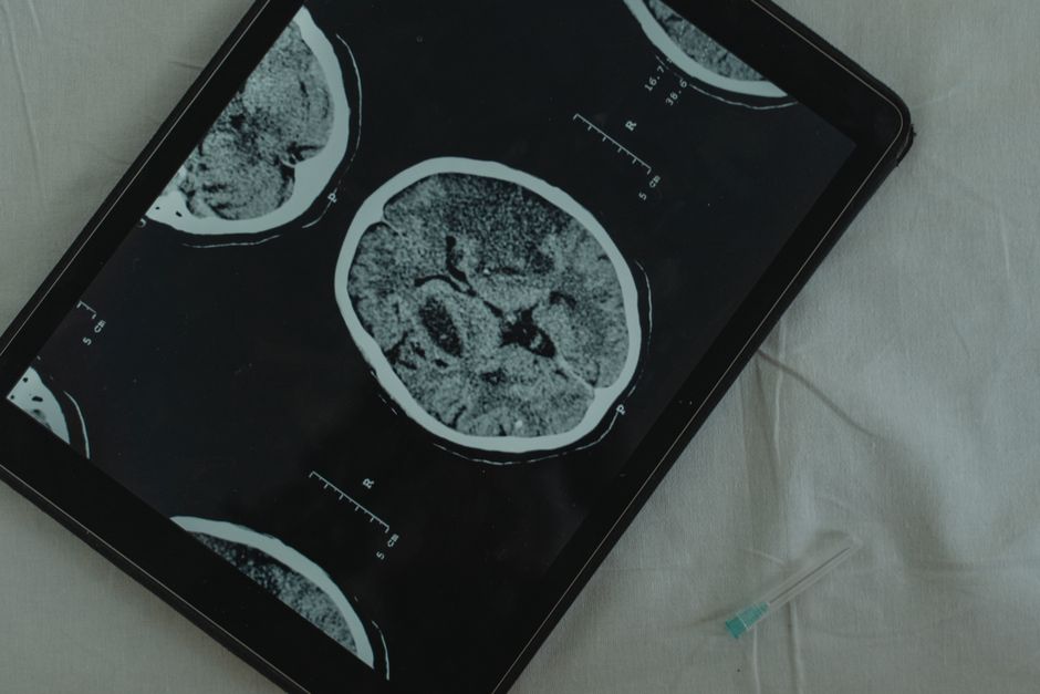 Early Signs of Neurological Disorders You Shouldnt Ignore illustration 2