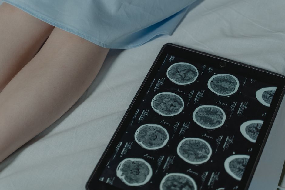 Early Signs of Neurological Disorders You Shouldnt Ignore illustration 6