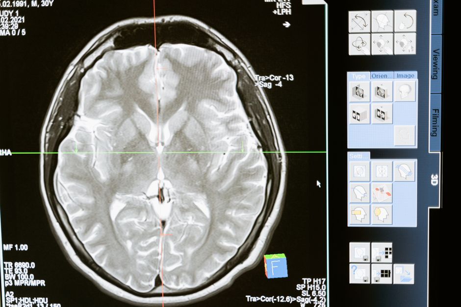Early Signs of Neurological Disorders You Shouldnt Ignore illustration 4