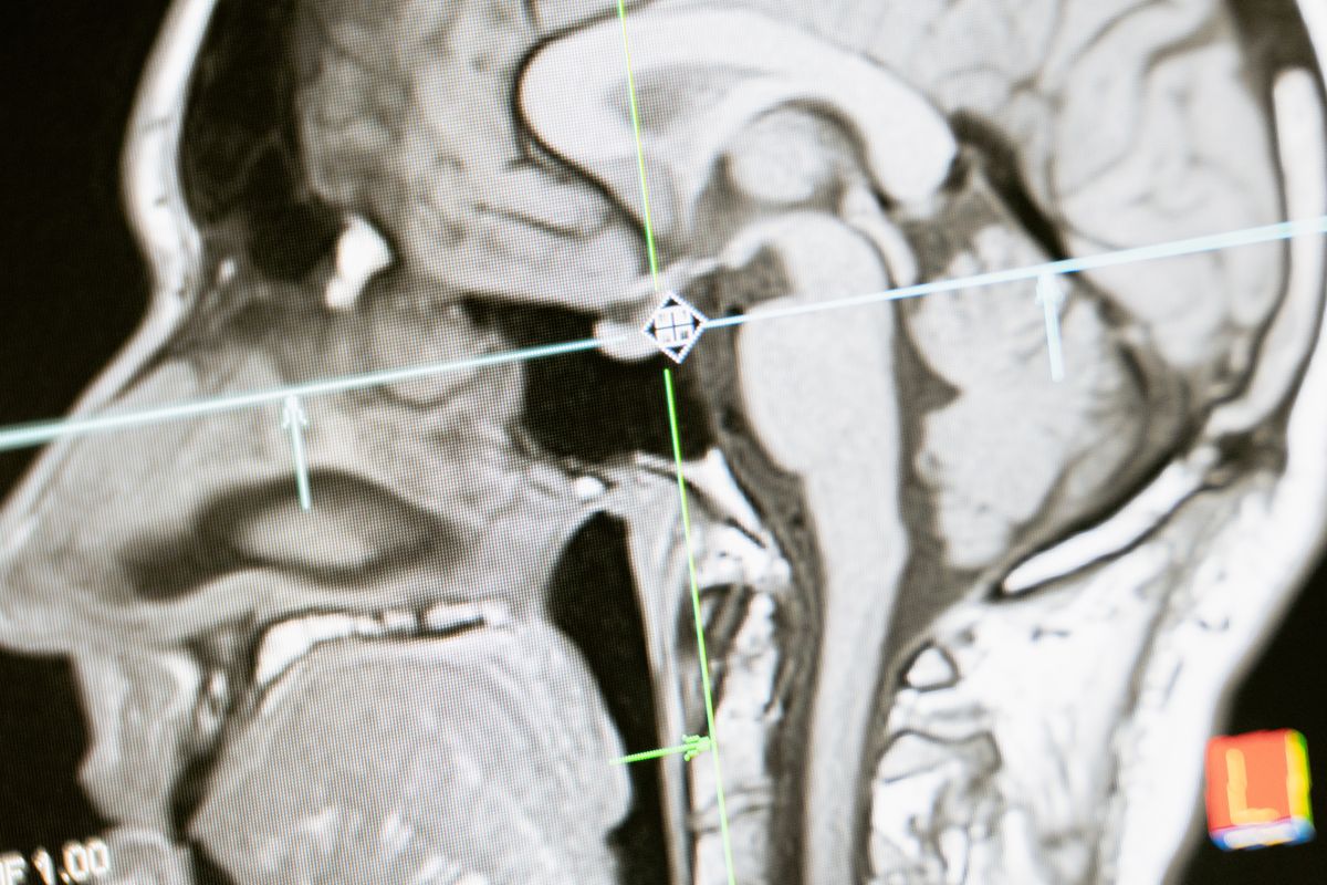 Early Signs of Neurological Disorders You Shouldnt Ignore illustration 1